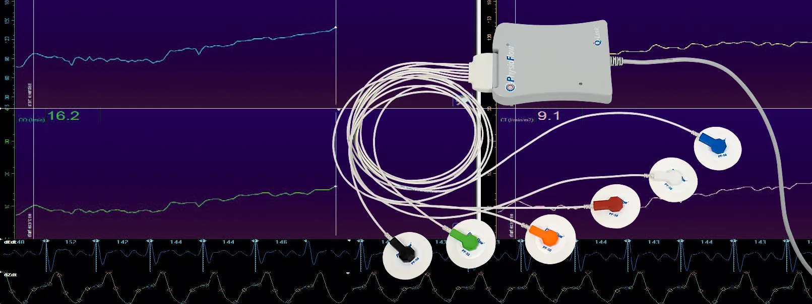 マナテック社 非侵襲インピーダンス心拍出量計 フィジオフロー